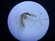 말라리아 현미경 사진