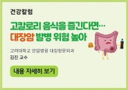 [건강칼럼] 고칼로리 음식을 즐긴다면… 대장암 발병 위험 높아