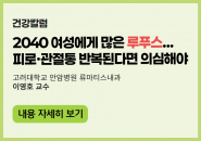 2040 여성에게 많은 루푸스... 피로·관절통 반복된다면 의심해야