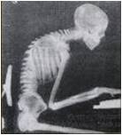 청소년 척추건강 학교를 아십니까?_1