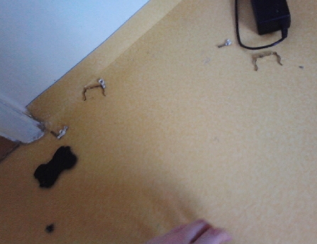 전기 감전 사고를 겪었어요_1